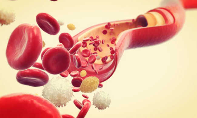 Anemia Aplastica Cause Sintomi e Terapia