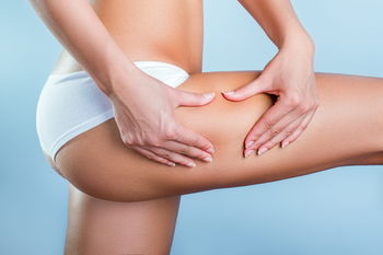 rimedi cellulite cosce